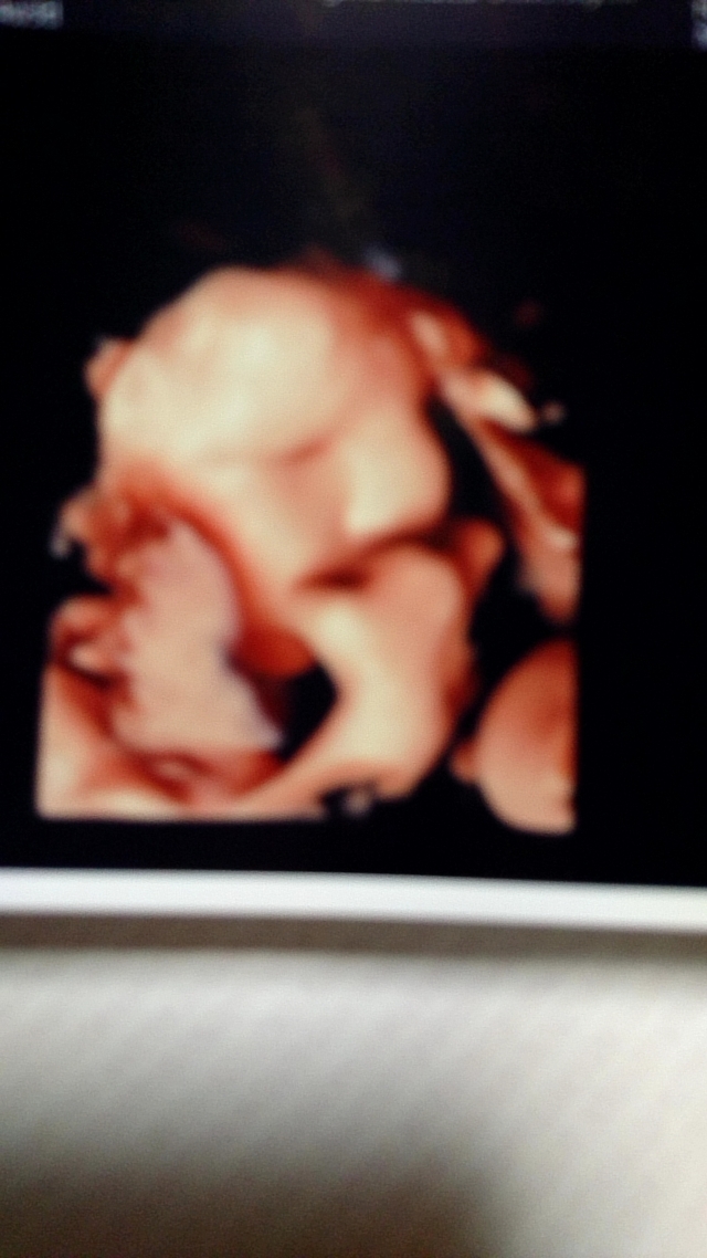 エコー写真 34週3日 34w3d 男の子,妊娠,34週,エコー写真