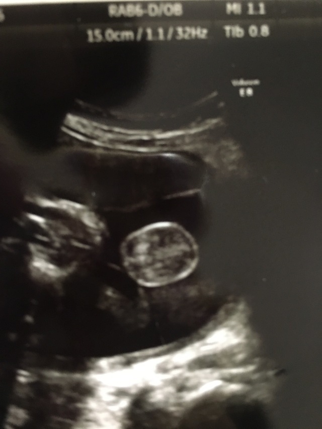 エコー写真 34週4日 34w4d 男の子,妊娠,34週,エコー写真