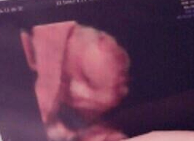 エコー写真 34週5日 34w5d 女の子,妊娠,34週,エコー写真