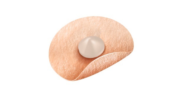 ピップエレキバン,