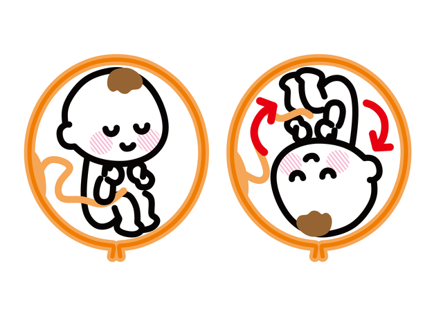 逆子,妊娠,8,ヵ月