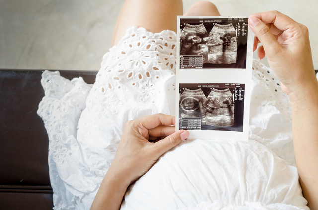 エコー写真,妊婦検診,費用,頻度