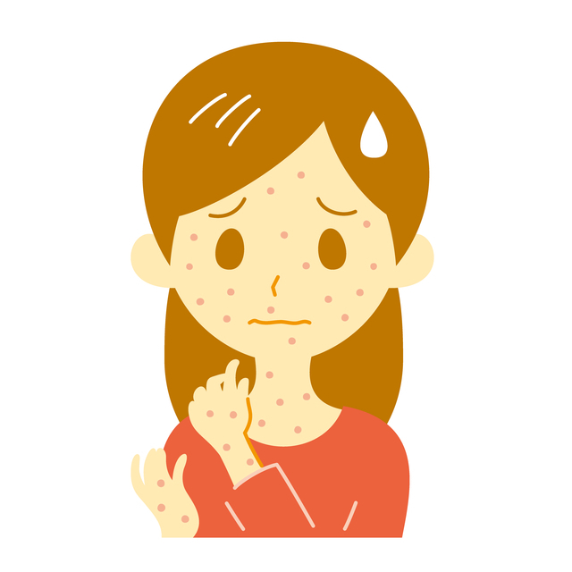 水ぼうそうイメージ,妊娠中,病気,