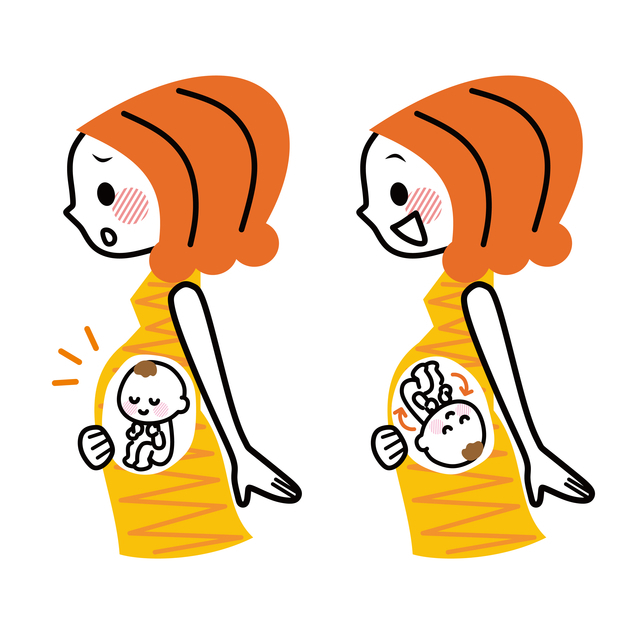 逆子イメージ,妊娠,後期,不安