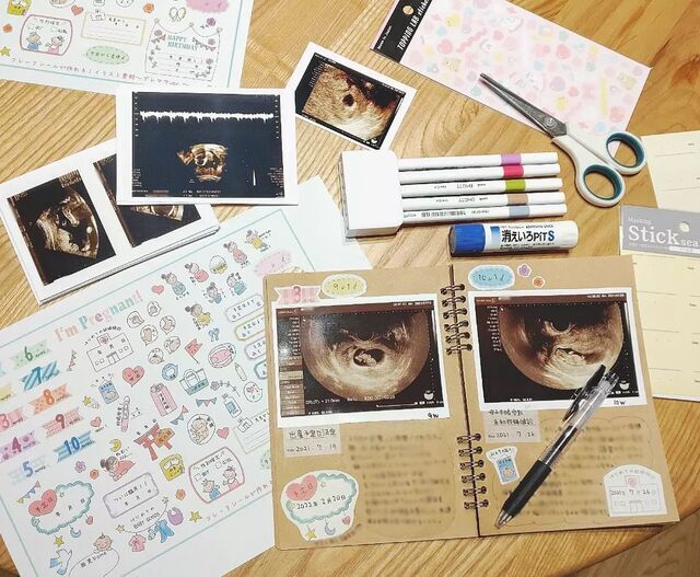 エコー写真活用例,フレークシール,作り方 使い方,育児日記 マタニティ