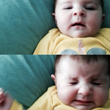 アレルギー性鼻炎